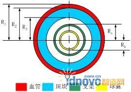 耦合模型截面